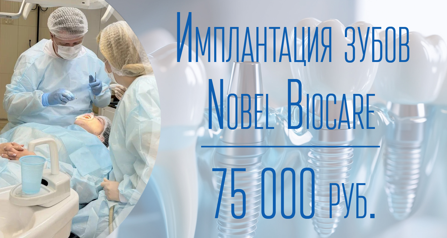 Имплантация за 75000 руб.